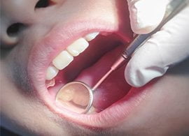 Mouth Cancer Get it checked out feature image