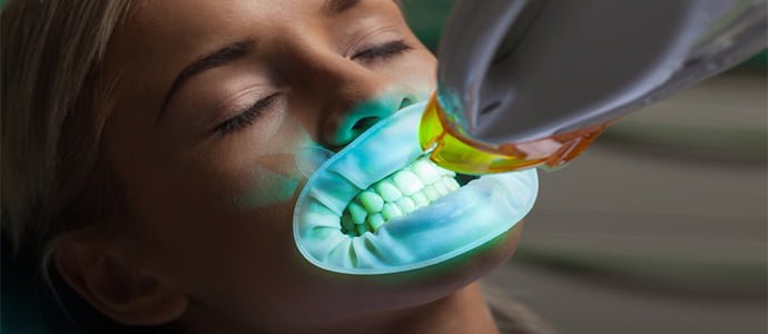 The clampdown on illegal teeth whitening treatments