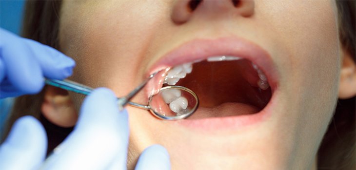 The benefits of private over NHS dental care