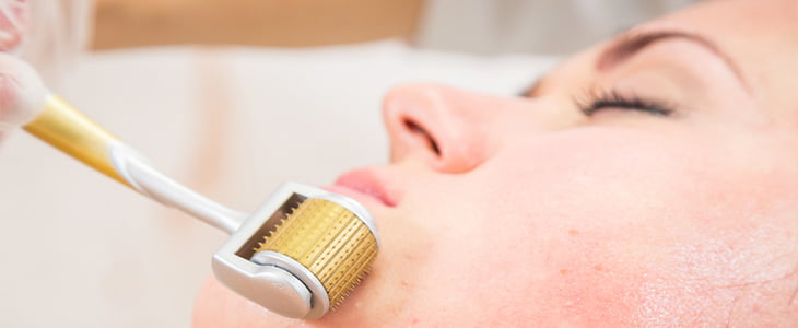 derma roller skin therapy