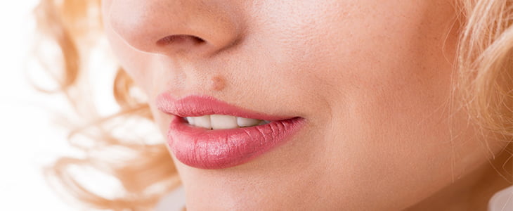 woman with mole on lip