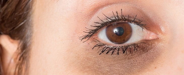 treatments for dark circles around eyes