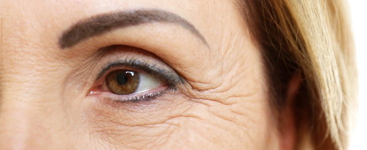 treating wrinkles