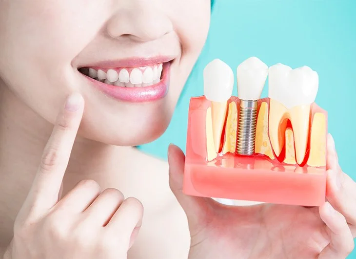 how safe are dental implants feature image