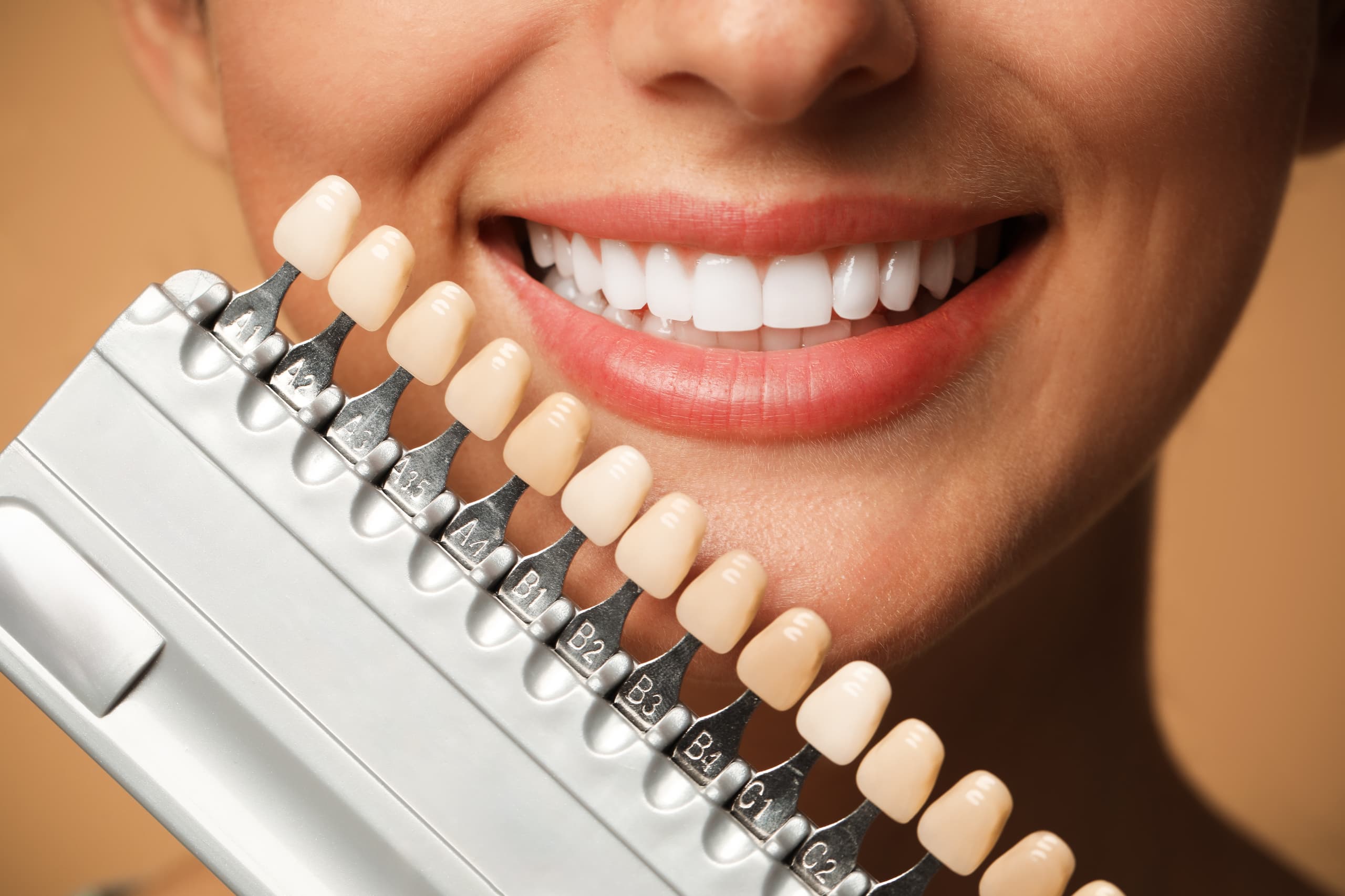 Close-up of a smiling patient comparing dental veneer shade samples against their teeth during a cosmetic dentistry consultation to select the most suitable veneer colour.