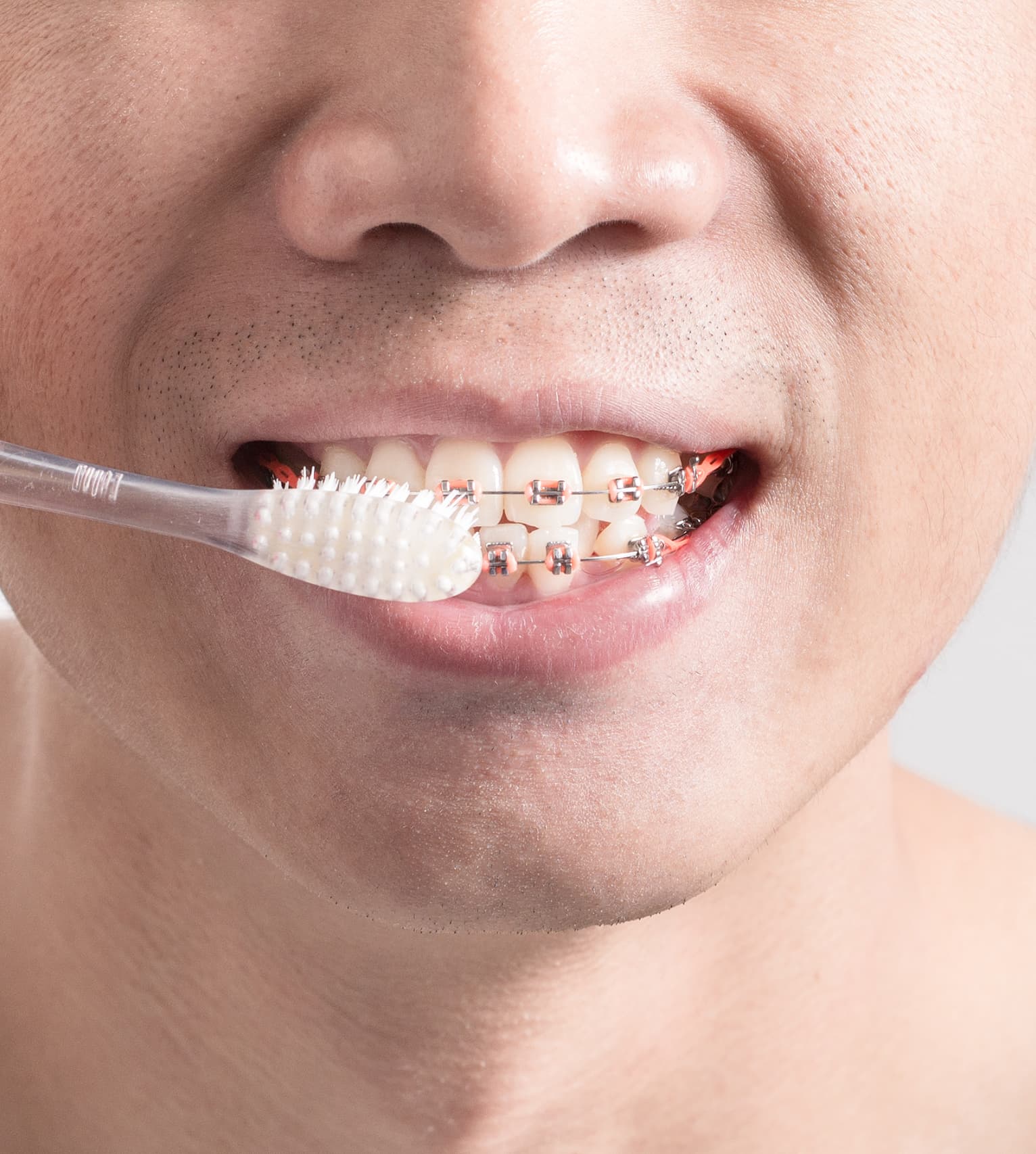 Close-up of a person brushing their teeth with braces using a toothbrush.