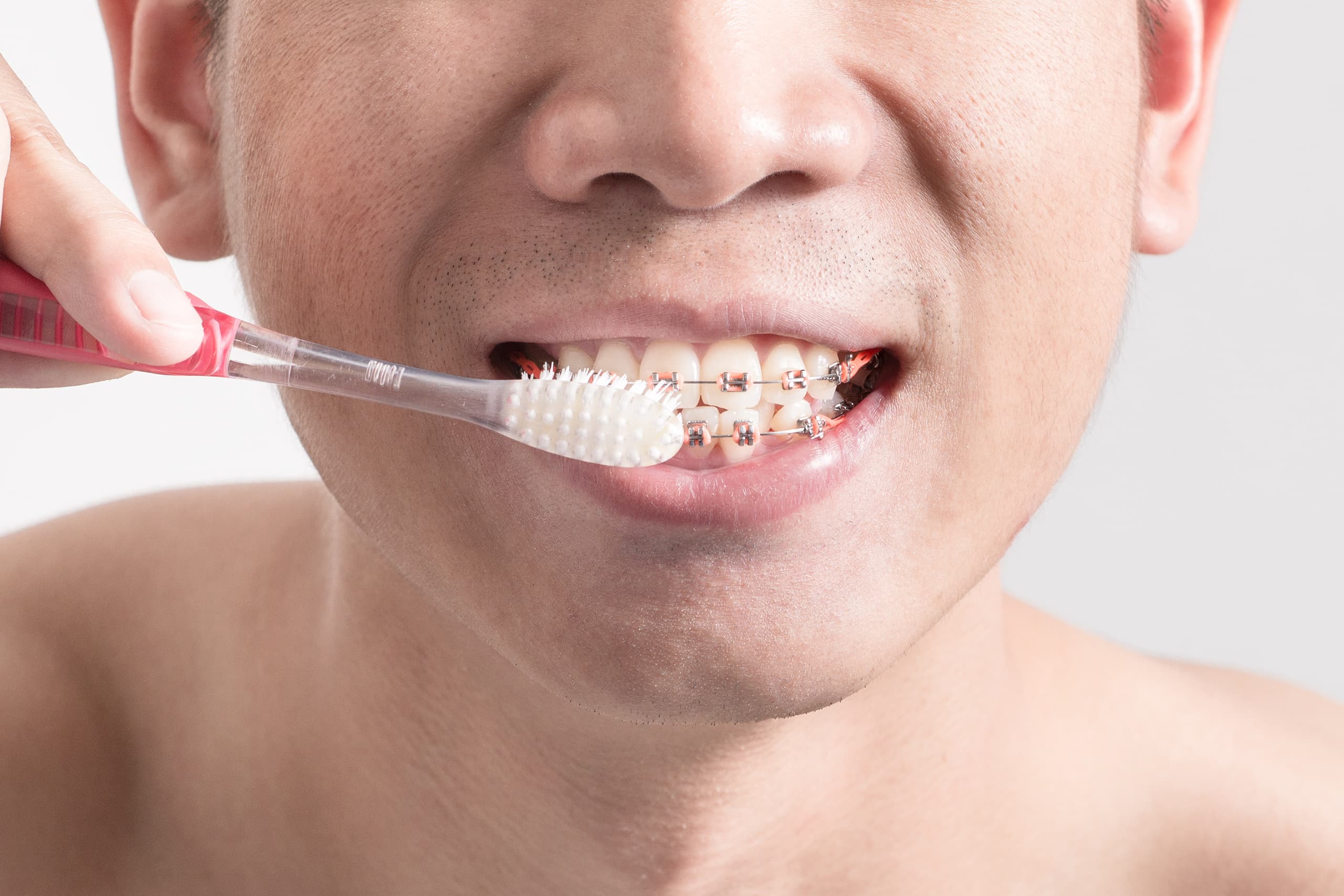 Close-up of a person brushing their teeth with braces using a toothbrush.