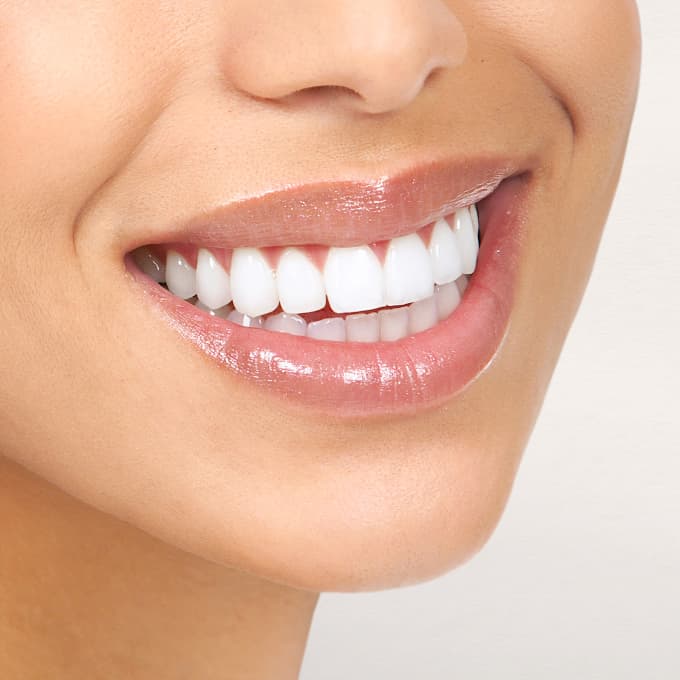 Close-up of a healthy smile showing bright white teeth and well-maintained oral health after cosmetic dental treatment or teeth whitening procedure