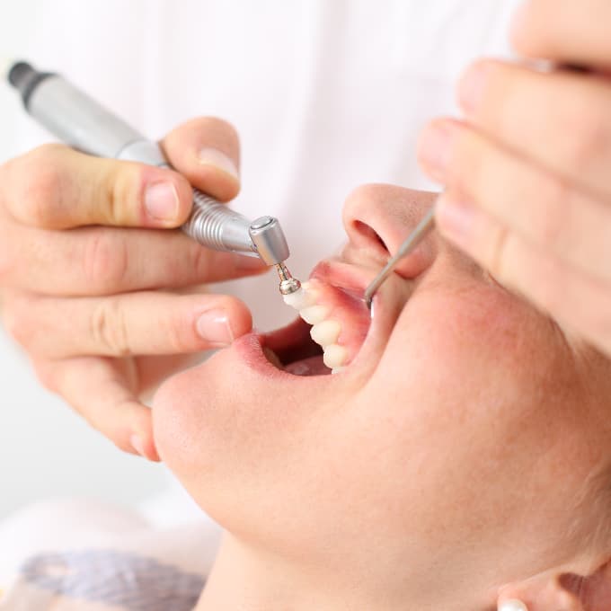 Dental professional using a polishing tool during a routine teeth cleaning and oral hygiene treatment appointment at a dental practice.