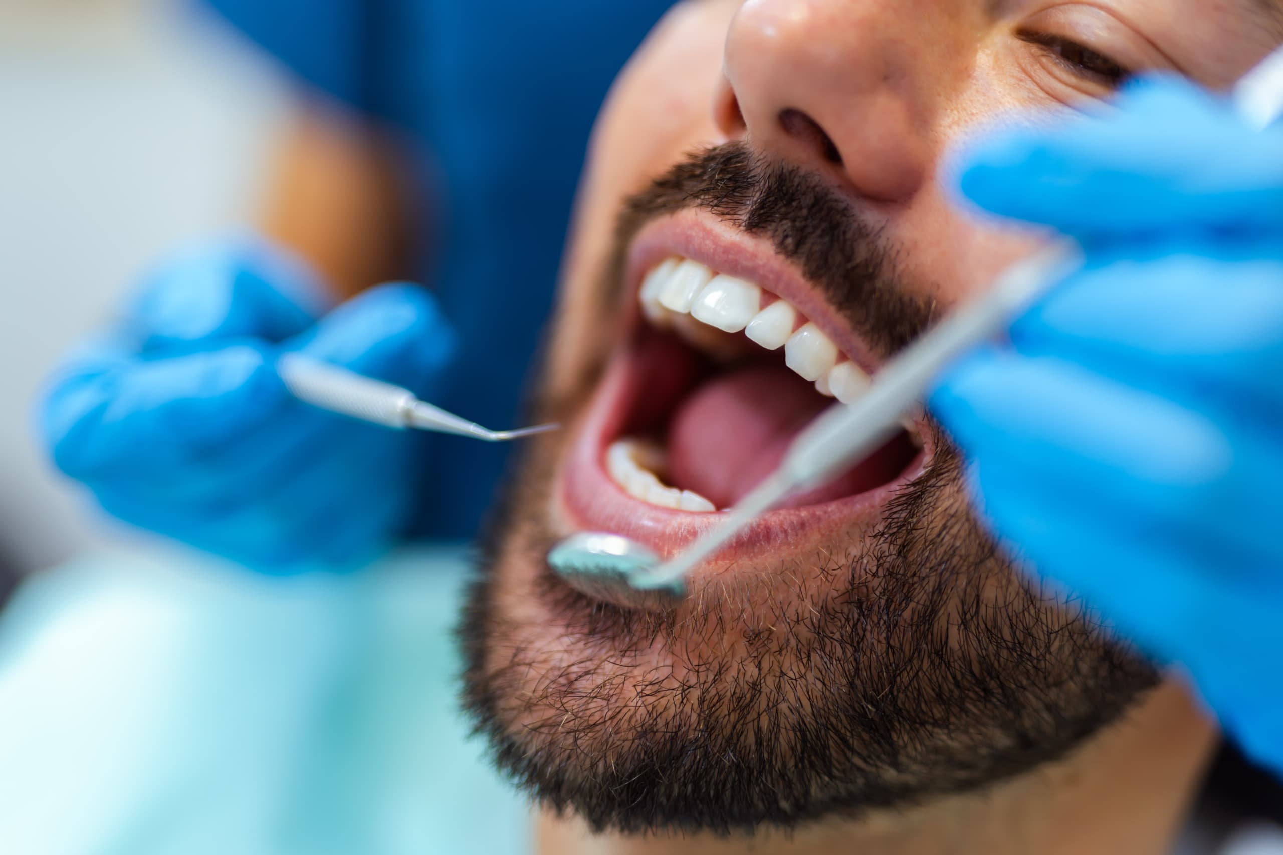 man with open mouth